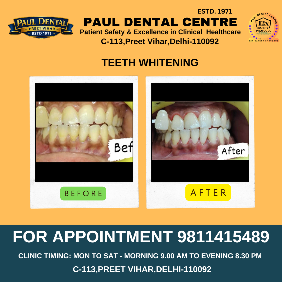 Case 33 – Paul Dental Center